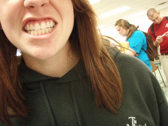 Lauren teeth
An accidental shot in Chemistry that turned out pretty cool
